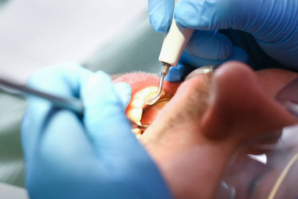 Best Broken or Cracked Tooth Emergency Dentist in Wyboo, SC