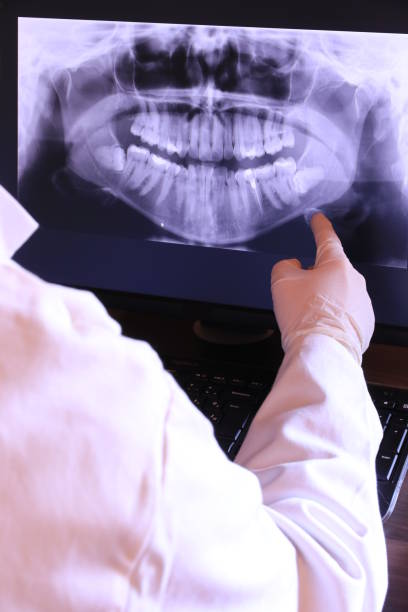 Best Mobile Emergency Dentist in Wyboo, SC